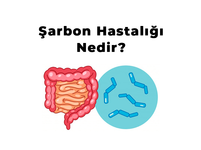 Şarbon hastalığı nedir